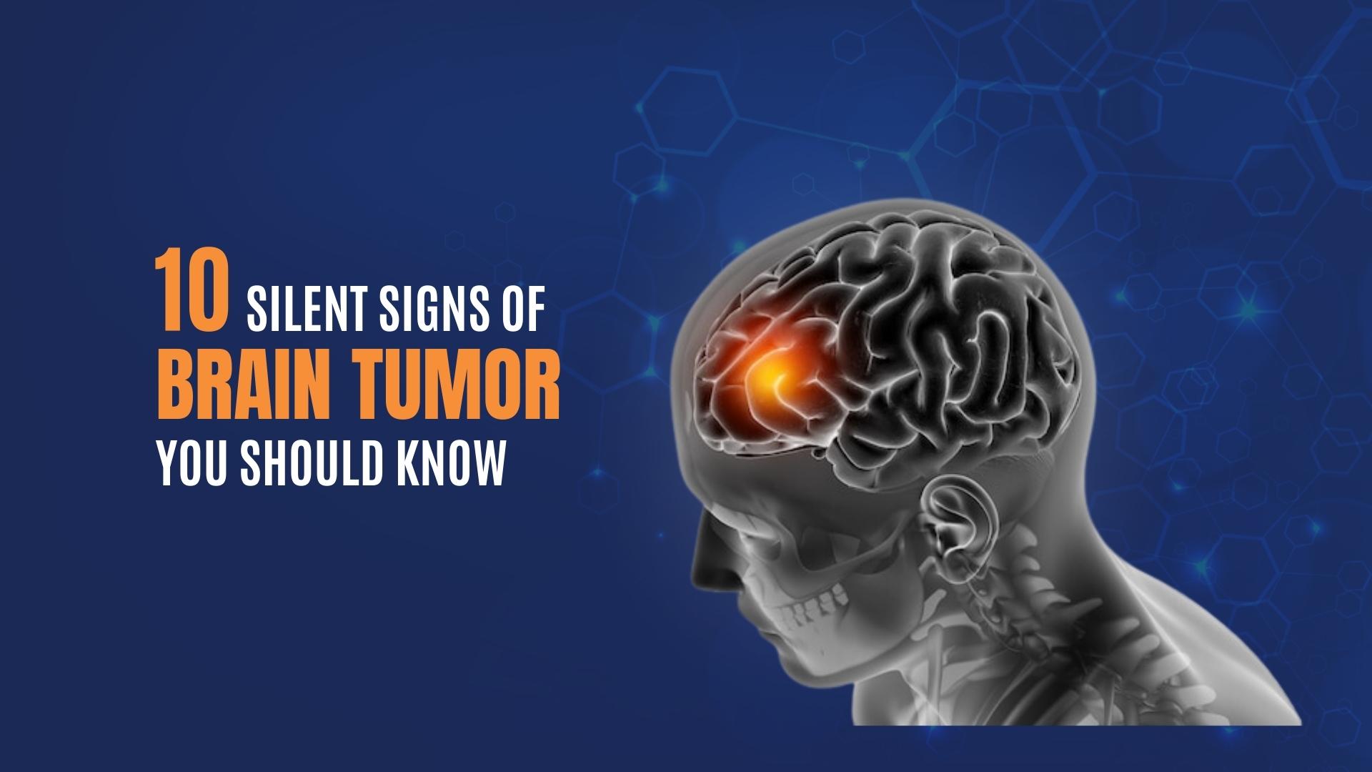 20 Silent Signs of Brain Tumor You Should Know   Wellness Hospitals