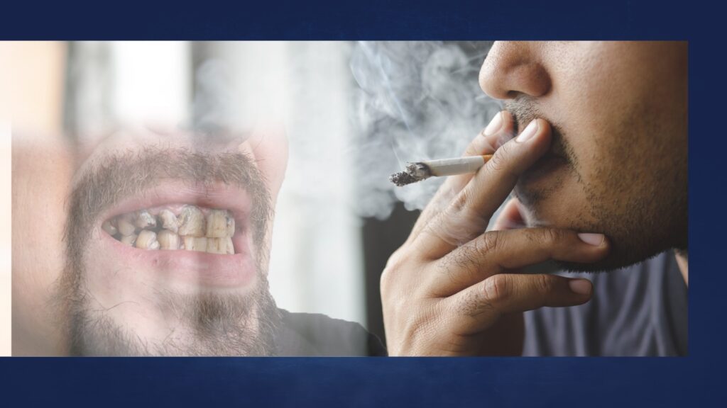 Tobacco's Effects on Oral Health