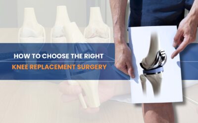 How to Choose the Right Knee Replacement Surgery for Your Budget and Needs at Wellness Hospitals