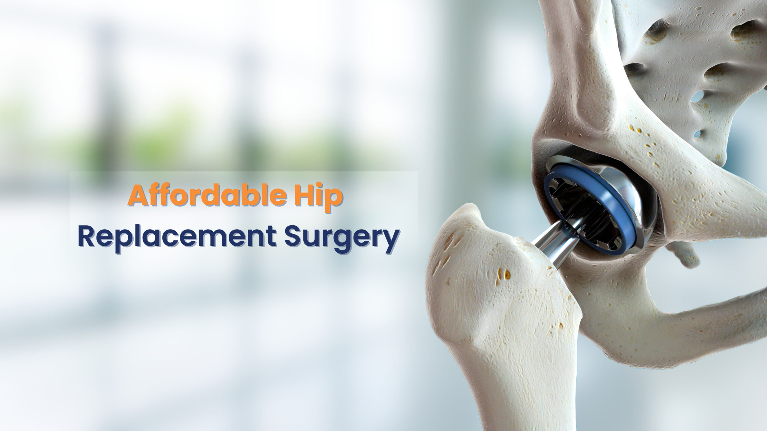 Affordable Hip Replacement Surgery Restoring Mobility And Quality Of