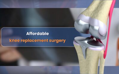 Affordable Knee Replacement Surgery at Wellness Hospitals