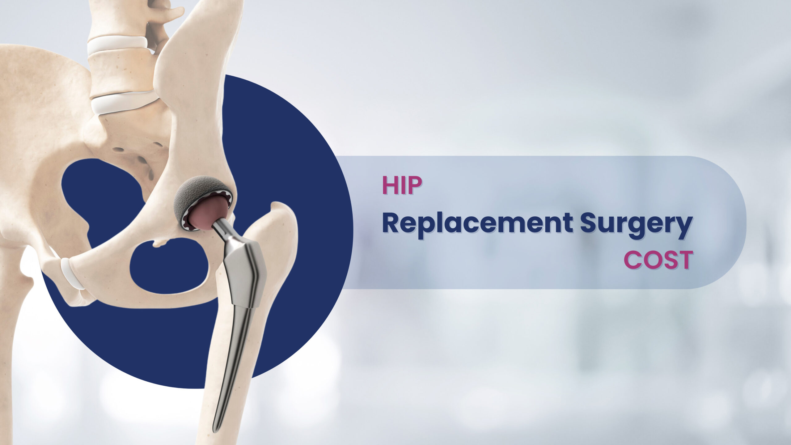 Average Hip Replacement Surgery Cost A Comprehensive Guide Wellness Hospitals 0087