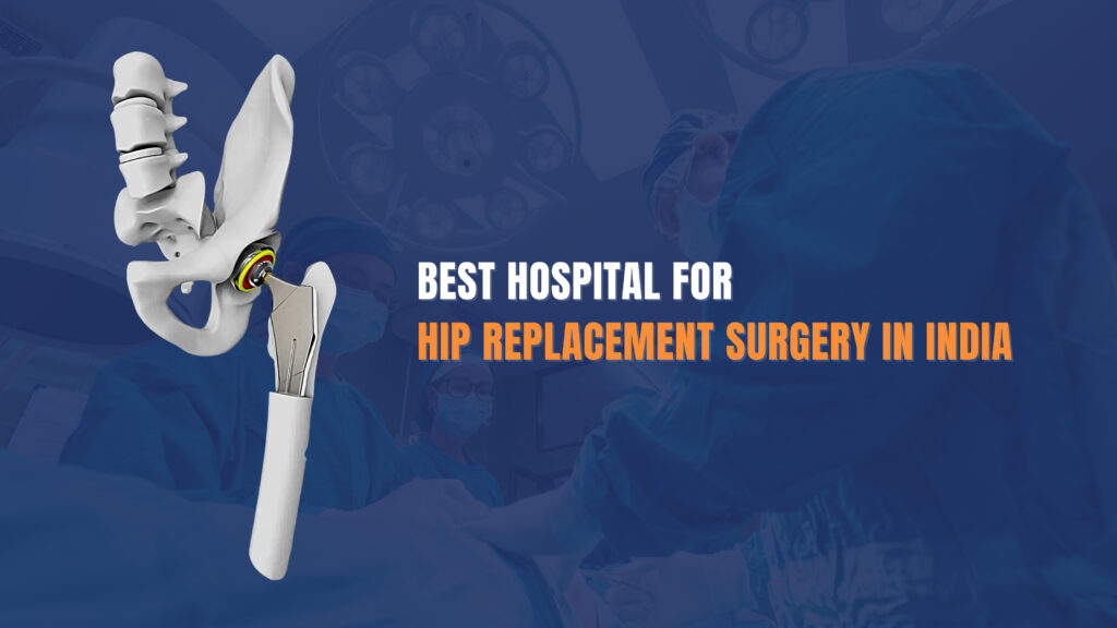 Best Hospital for Hip Replacement Surgery in India Expert Insights
