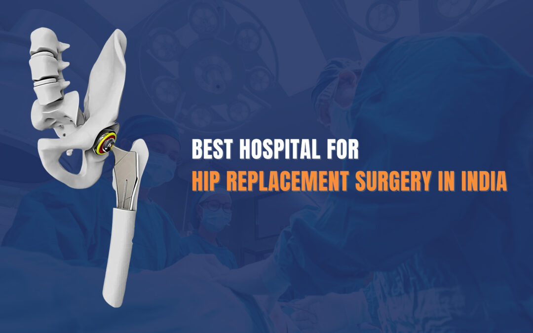 Best Hospital for Hip Replacement Surgery in India – Expertise and Excellence Combined