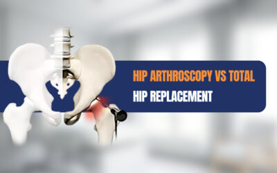 Hip Arthroscopy vs Total Hip Replacement: A Comprehensive Comparison