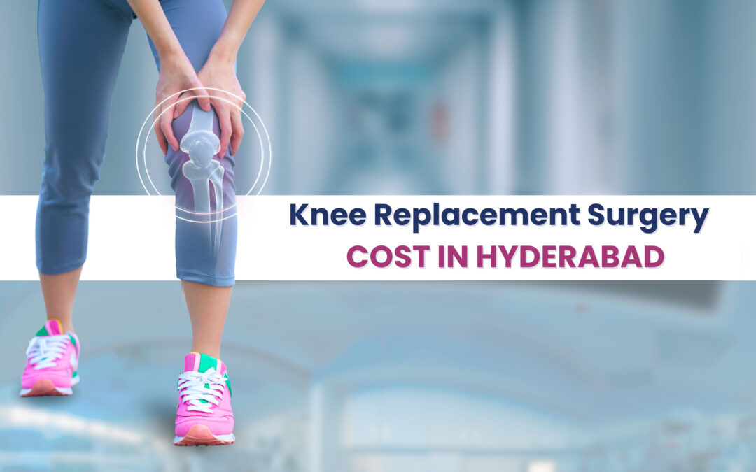 An image showcasing the excellence of Knee Replacement Surgery in Hyderabad