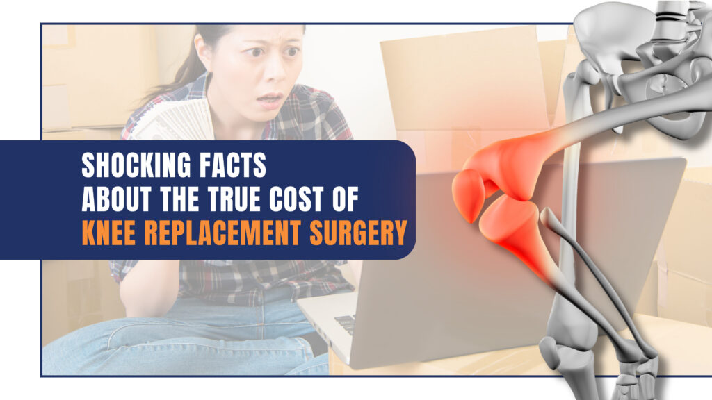 Shocking Facts About The True Cost Of Knee Replacement Surgery 2023 Revealed Wellness Hospitals