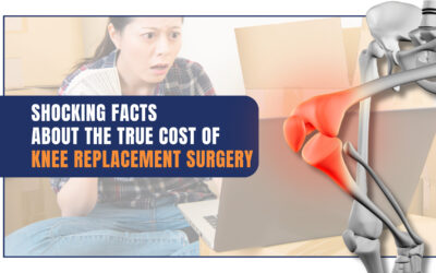 Shocking Facts about the True Cost of Knee Replacement Surgery 2023– Revealed!