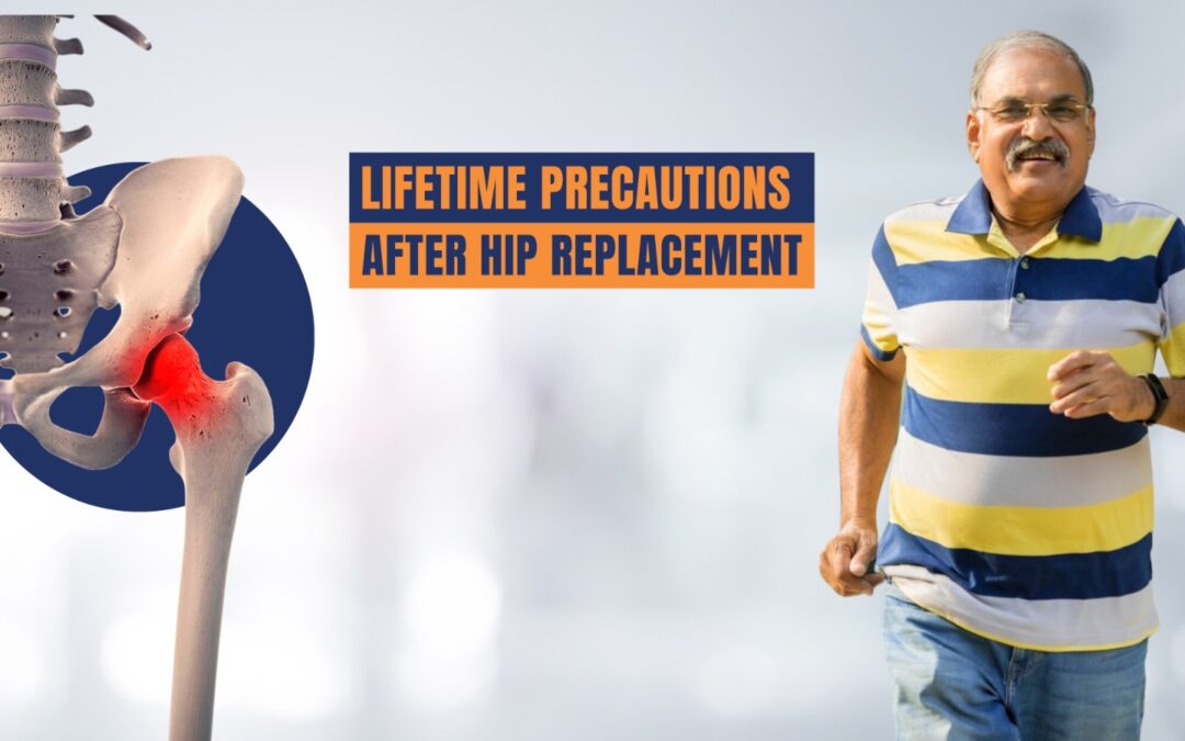 Image showing a person walking with the support of crutches after hip replacement surgery.-Lifetime Precautions After Hip Replacement