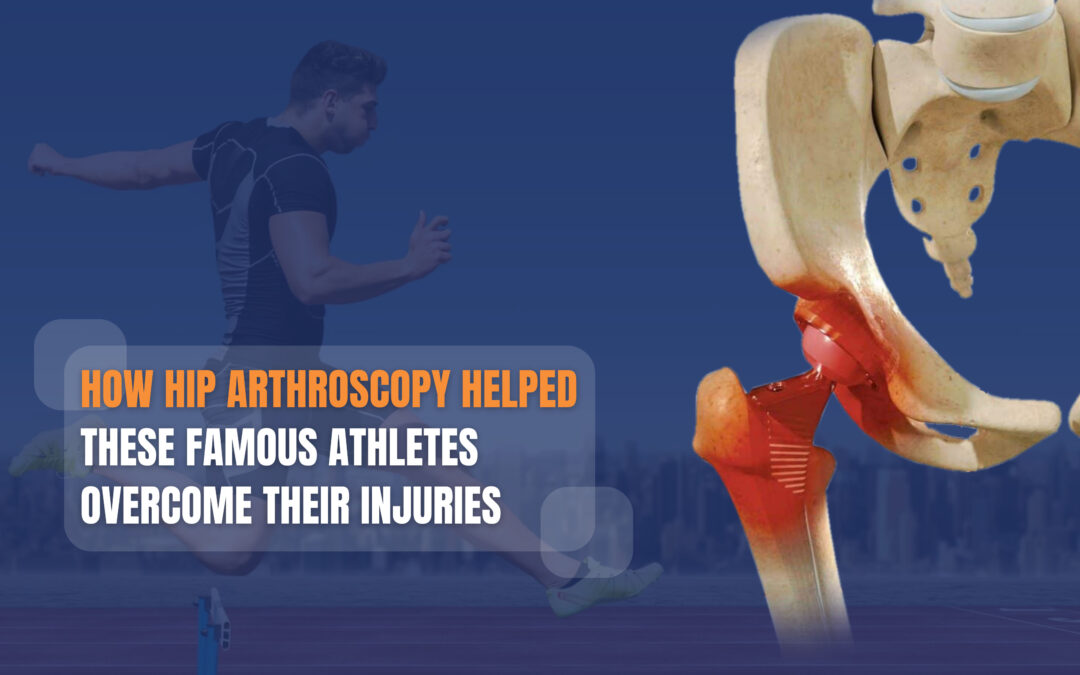 A collage of six famous athletes who have received hip arthroscopy: Tyson Gay, Nicklas Backstrom, Alex Rodriguez, Andy Murray, Lady Gaga, and Cristiano Ronaldo
