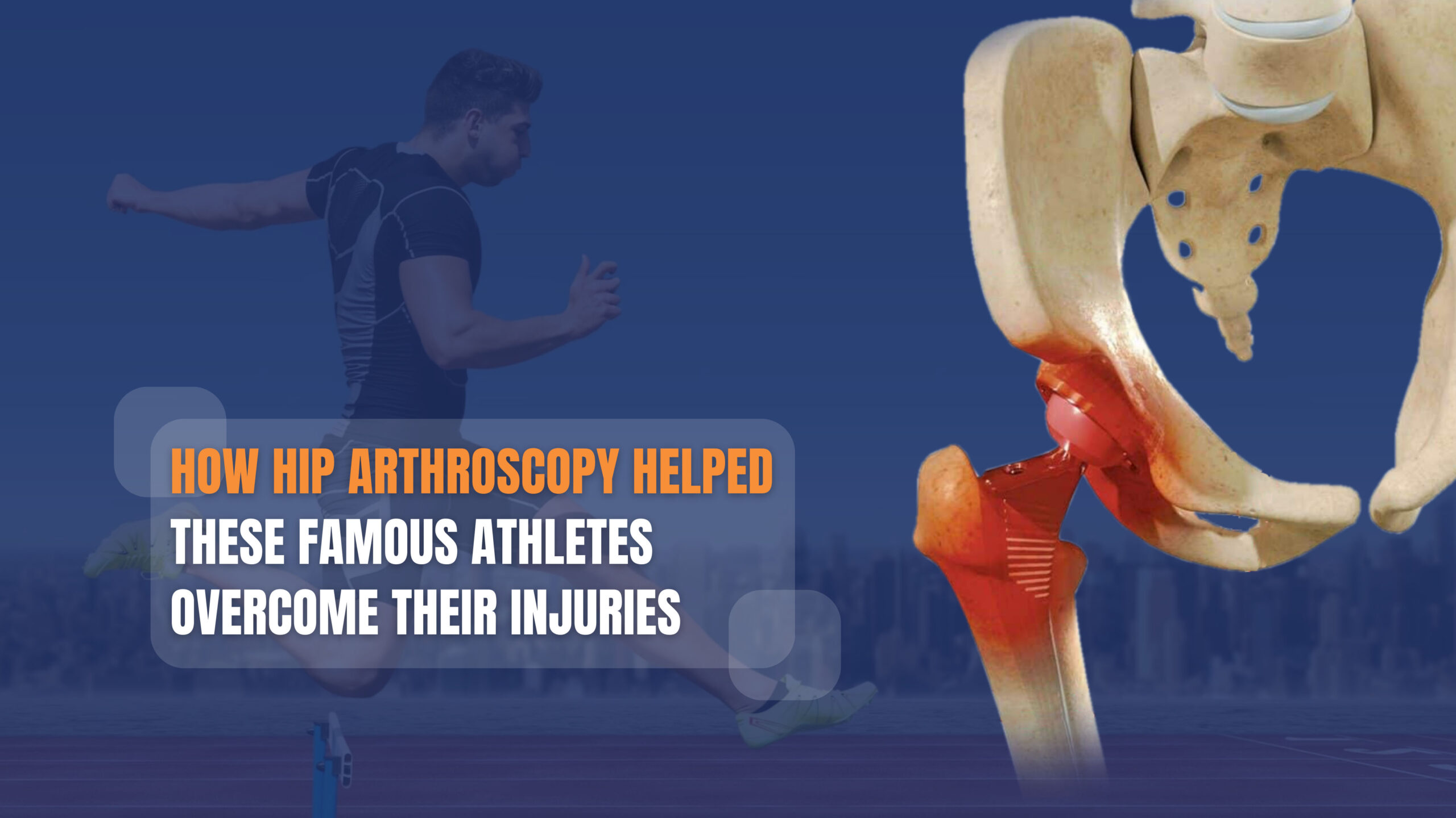 How Hip Arthroscopy Helped These Famous Athletes Overcome Their Injuries And Achieve Their Goals 3763