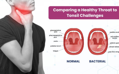 1 From Discomfort to Relief: Navigating Tonsil Issues with Expert Care