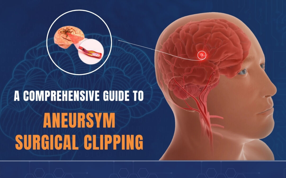 Aneurysm Mastery: Step-by-Step Guide to Surgical Clipping