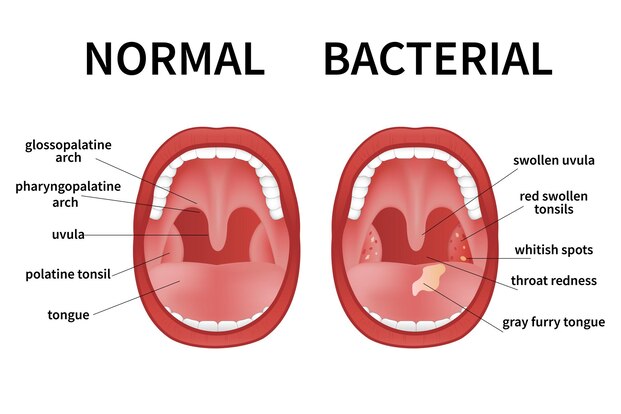 From Discomfort To Relief 1 Navigating Tonsil Issues With Expert Care   Tonsils Pic 