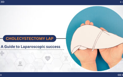 Laparoscopic Cholecystectomy for Optimal Recovery