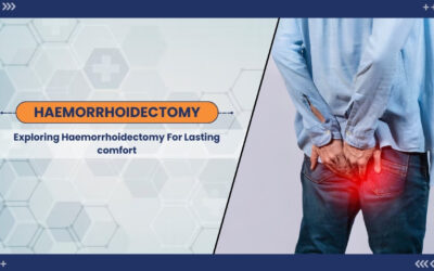 Navigating Haemorrhoidectomy – A Comprehensive Guide to Surgical Solutions and Recovery