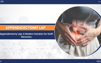 A Modern Approach with Laparoscopic Appendectomy