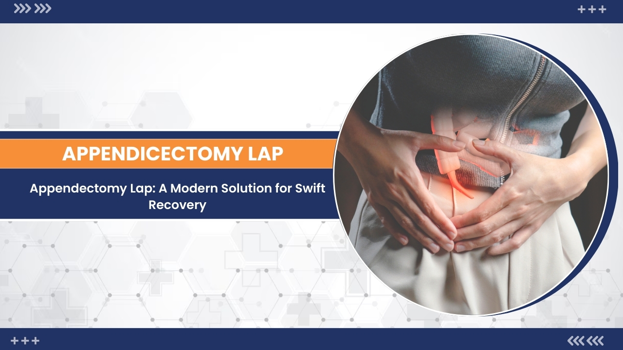 A Modern Approach With Laparoscopic Appendectomy - Wellness Hospitals