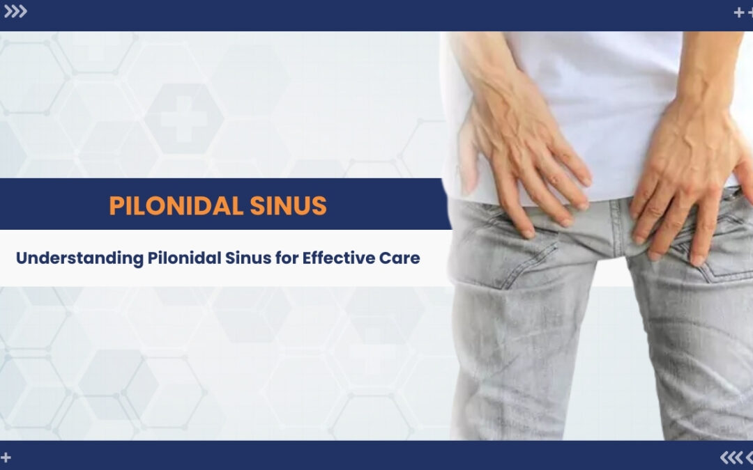 Surgical Symphony: The Expertise Behind Pilonidal Sinus Treatment