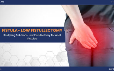Your Complete Guide to low fistulectomy: Navigating the Surgical Journey