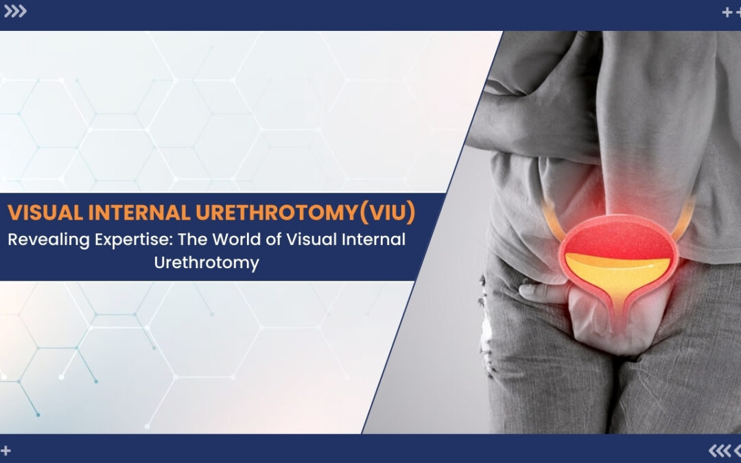 Visual Internal Urethrotomy