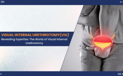 Optimal Urological Care: 1 Navigating Visual Internal Urethrotomy (VIU) at the Best Hospital in India – Wellness Hospitals