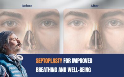 Breathe Freely: A Comprehensive Guide to Septoplasty and Choosing the Best Hospital