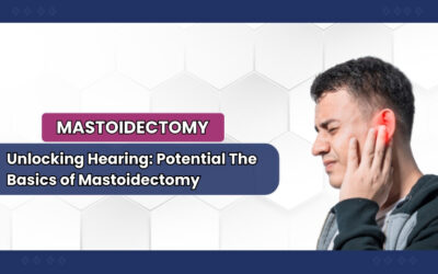 Mastering Mastoidectomy: Navigating Excellence at the Best Hospital for Ear Health
