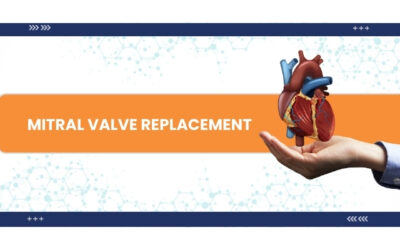 Mitral Valve Replacement cost