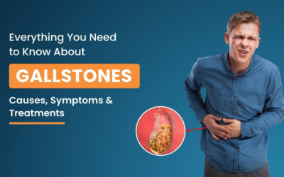 Gallstones Guide: New Solutions for a Pain-Free Life