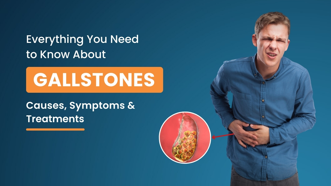 Gallstones Guide: New Solutions for a Pain-Free Life