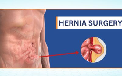 Affordable Hernia Surgery In Hyderabad | Know About Hernia Today.